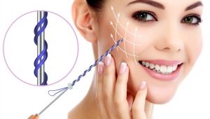 ¿Cómo utilizar el hilo para la cirugía estética?