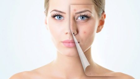 Sorunlu cilde nasıl bakım yapılır?