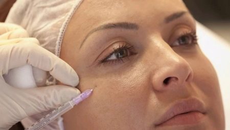 Facial mesotherapy: Vad är det och hur är det gjort?