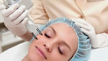 Laser facial rejuvenation: features, types and technology of