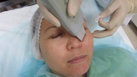 Pravidla pro čištění obličeje ultrazvukem