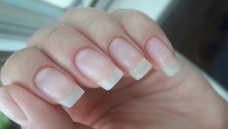 How to restore nails after shellac?