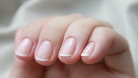 Orsaker och behandling av nagelkutellinflammation