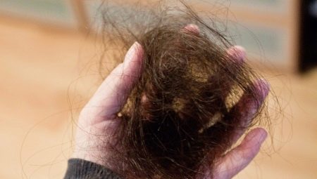 Saç salkımlarında dökülür: nedenleri ve çözümü