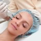 Rejuvenecimiento facial con láser: características, tipos y tecnología de